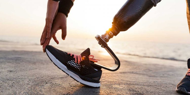 Junge Joggerin neigt sich zum Stretch zu ihrer Beinprothese